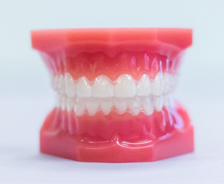 invisalign aligners on plastic model