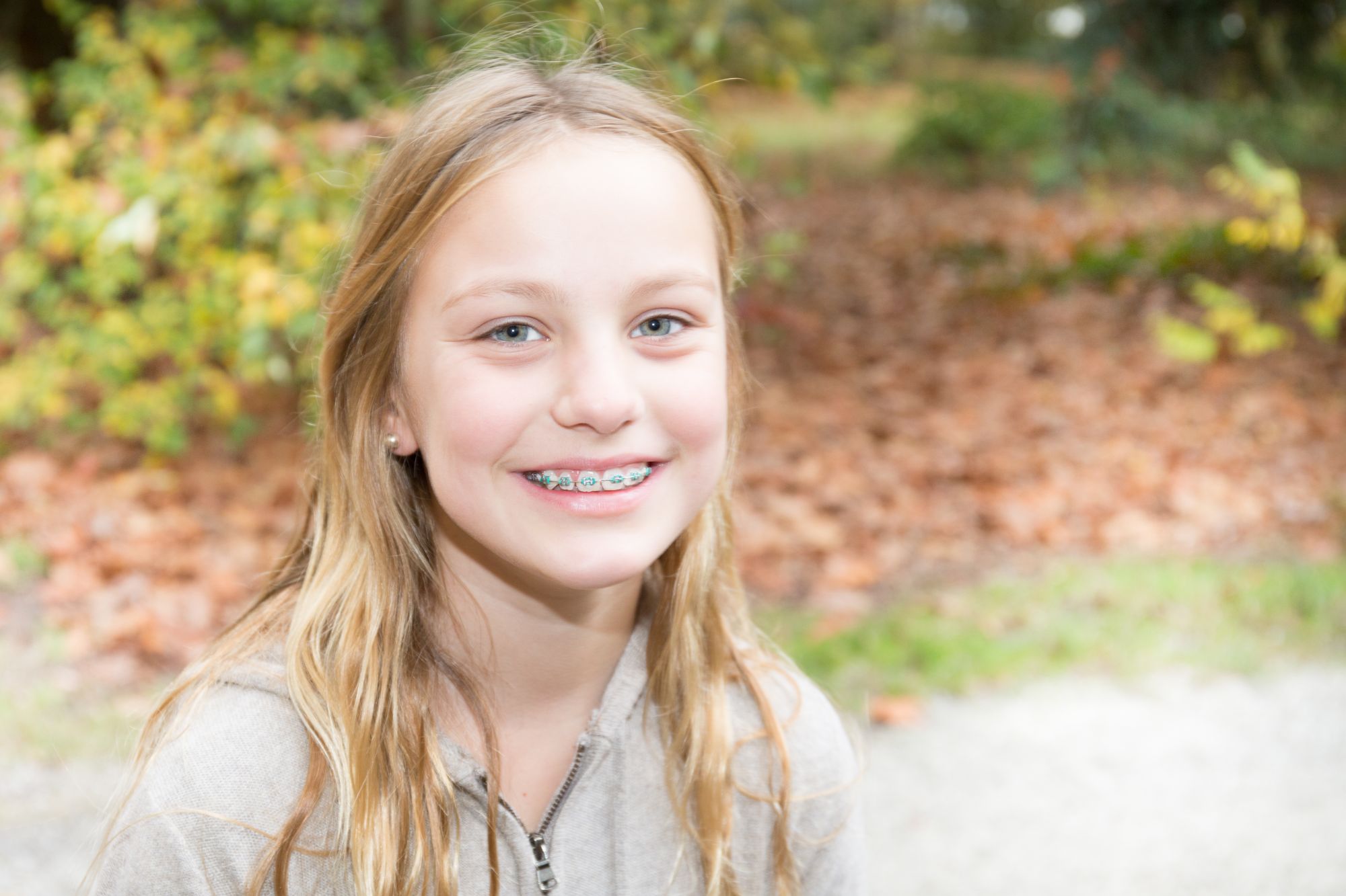 Braces Lake Mary FL