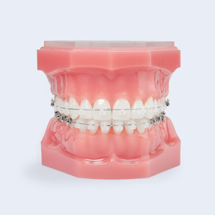clear braces lake mary